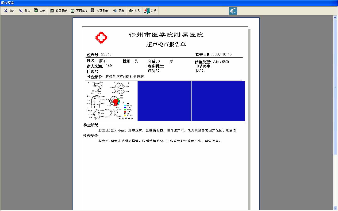 打印预览